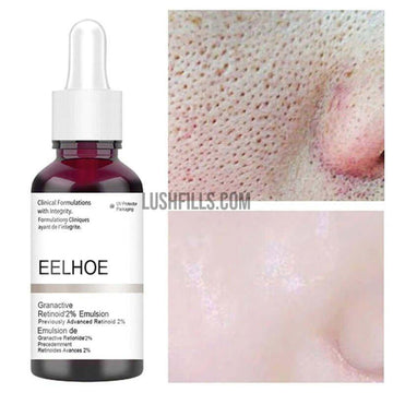 Anti Acne Exfoliating Face Serum Peeling Solution Pore Shrinking Face Skin Care Treatments serum