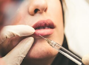 Tips for a Smooth Dermal Filler Recovery-Lushfills.com