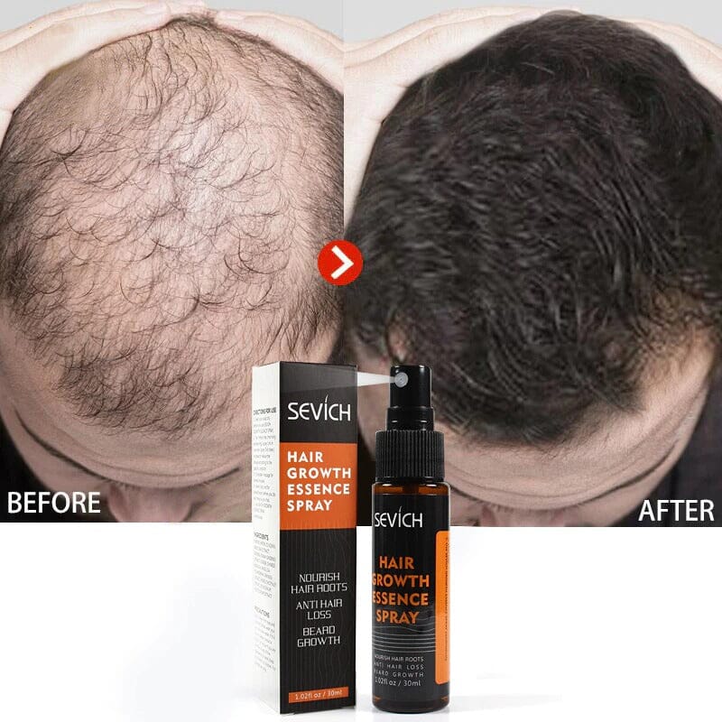 Natural hair loss treatment and Restoration