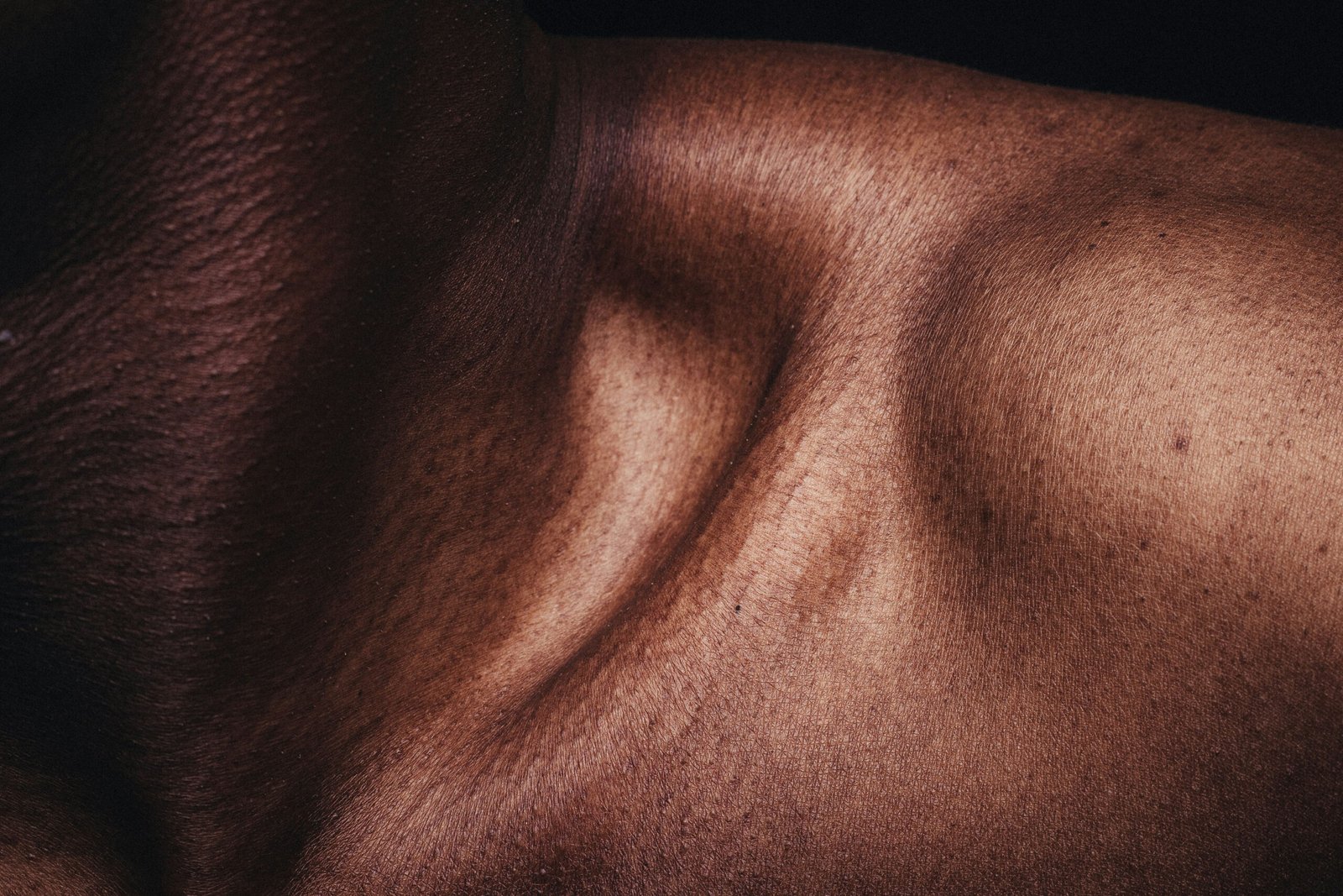 Skin Boosters for Acne-Prone Skin