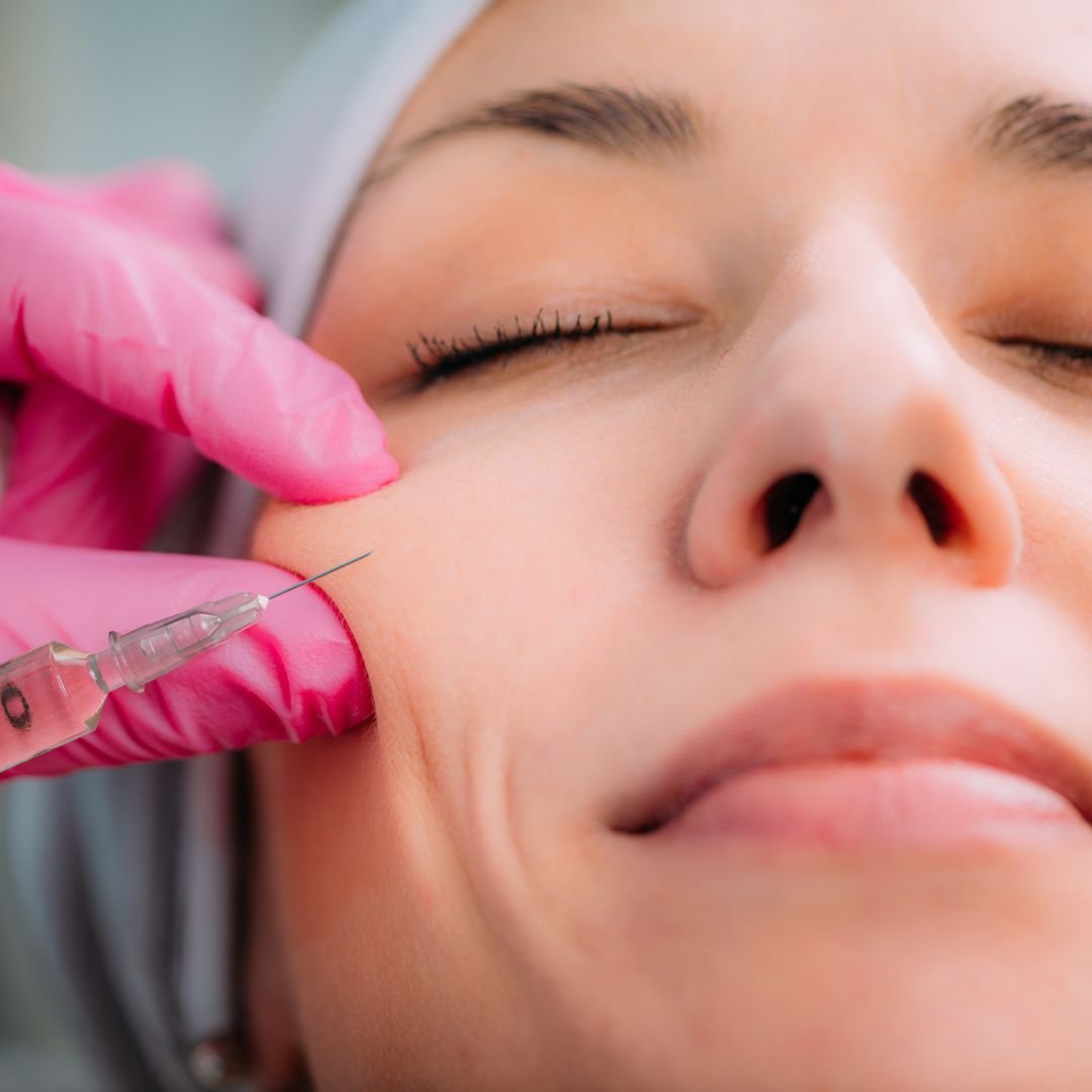 Choosing the Right Dermal Filler