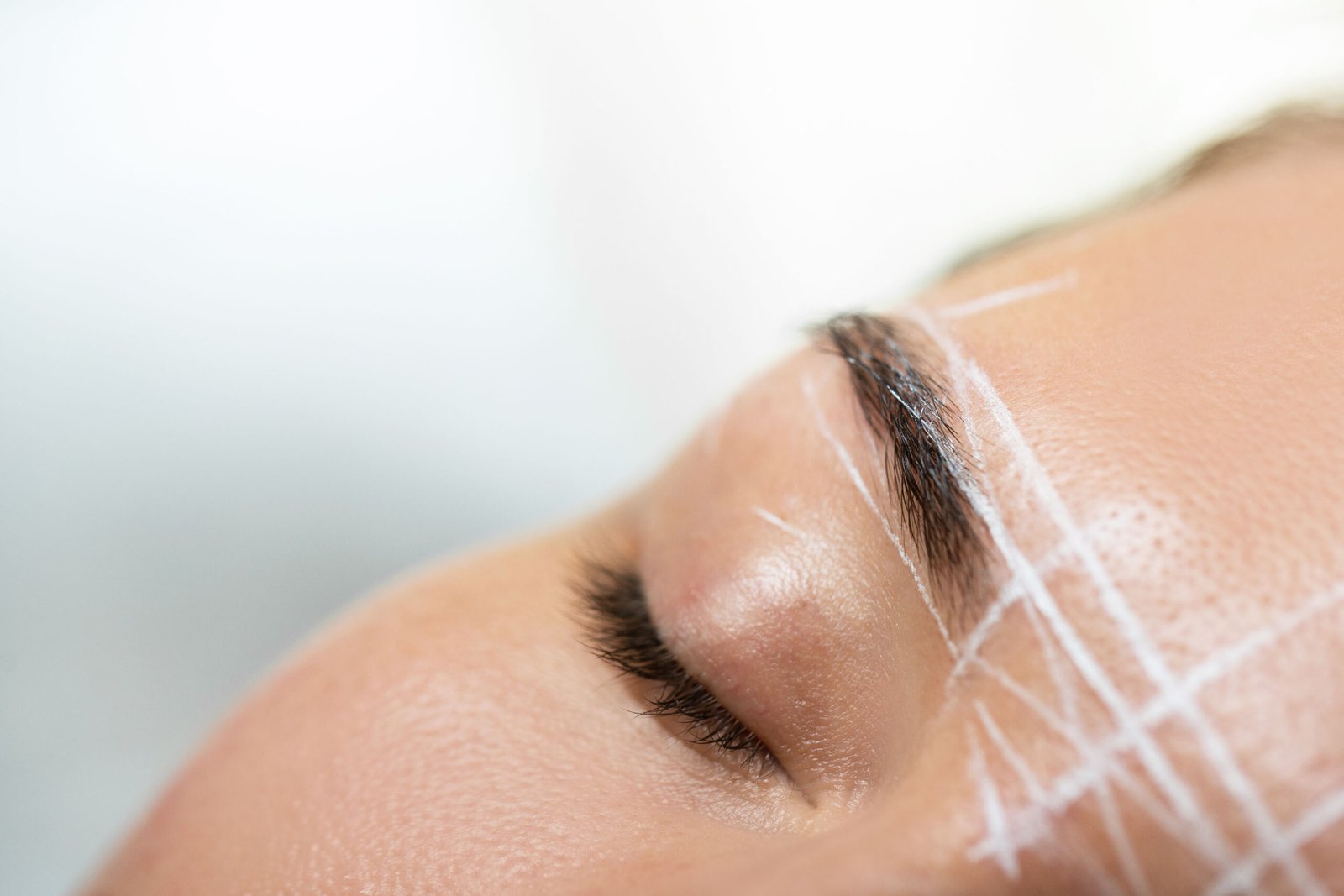 Collagen Stimulation for Non-Surgical Brow Lifts