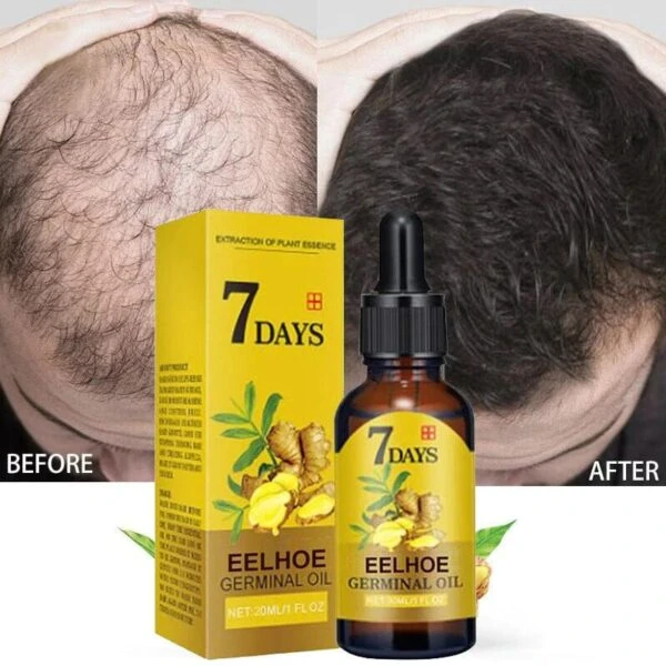 Fast natural hair Growing serum