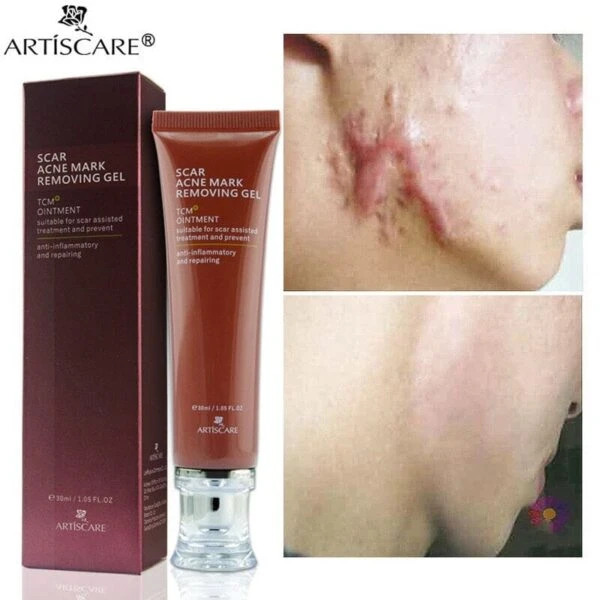 Natural anti scar removal gel